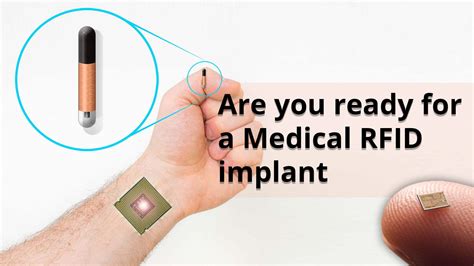 detecting rfid micro chip on body|How Do I Know If I Have A RFID Chip .